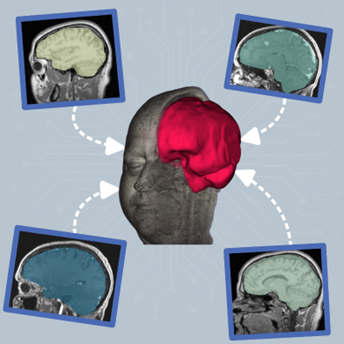 Figure 2 placeholder