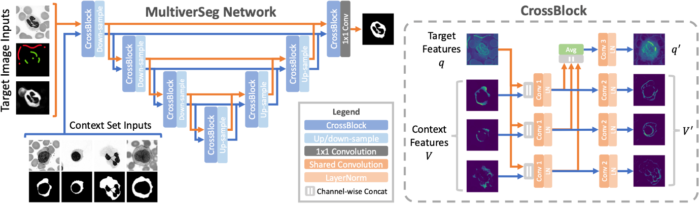 MultiverSeg and the promise of AI for faster clinical research